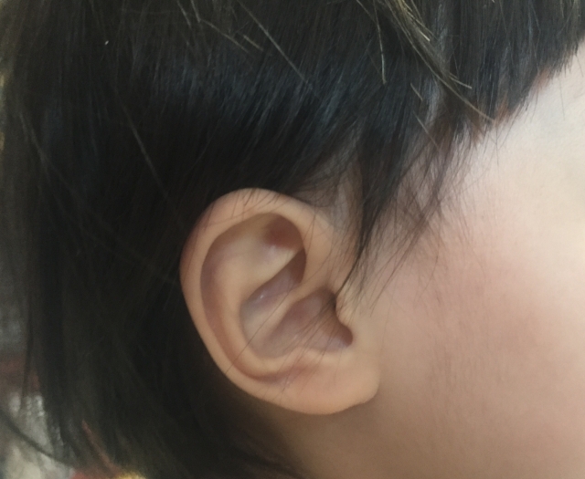子供 赤ちゃんの中耳炎 耳を触る 耳垂れが出る なら尼崎の にこにこクリニック へ