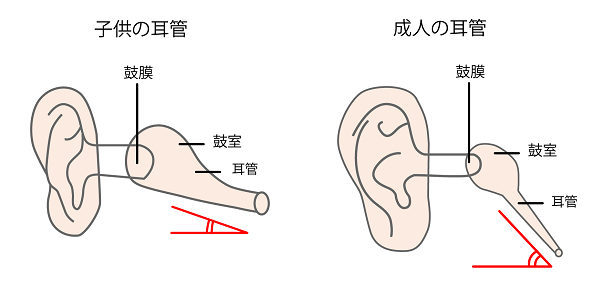 痛い が の 耳 中