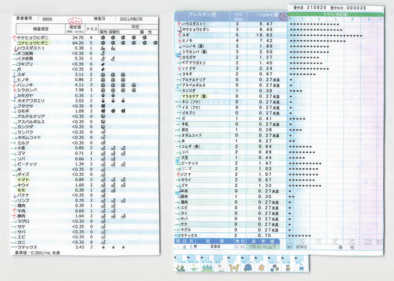  Drop Screen A-1とViewアレルギー39（外注検査）項目での比較