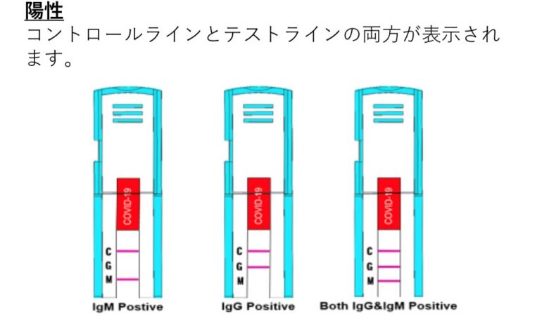 検査 アメリカ コロナ 抗体